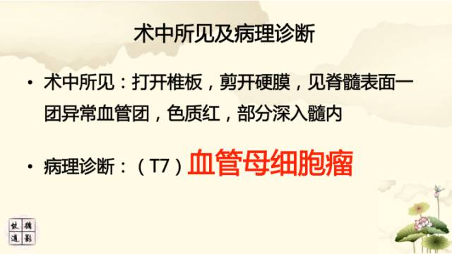 【病例】脊髓血管母细胞瘤1例MR影像诊断分析