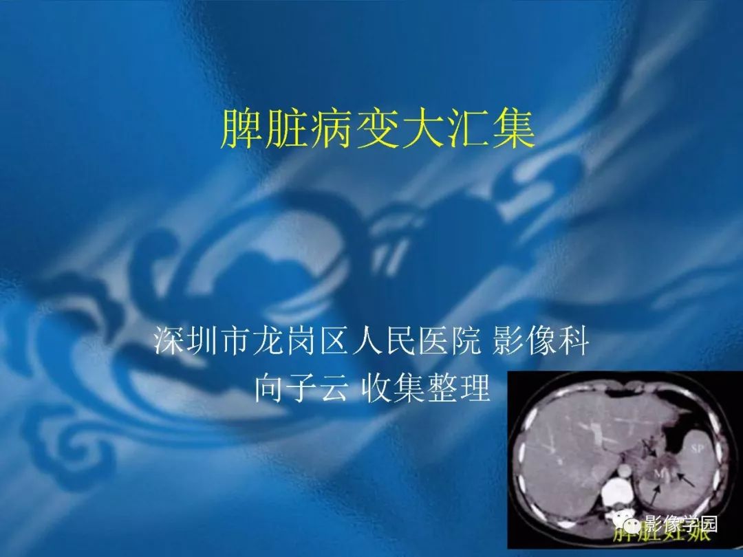 【PPT】脾脏病变大汇集
