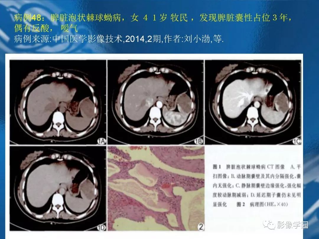 【PPT】脾脏病变大汇集