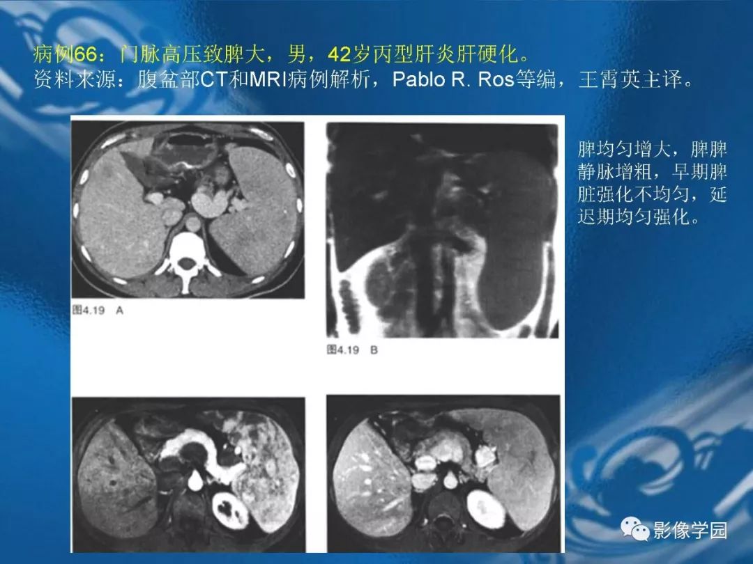 【PPT】脾脏病变大汇集