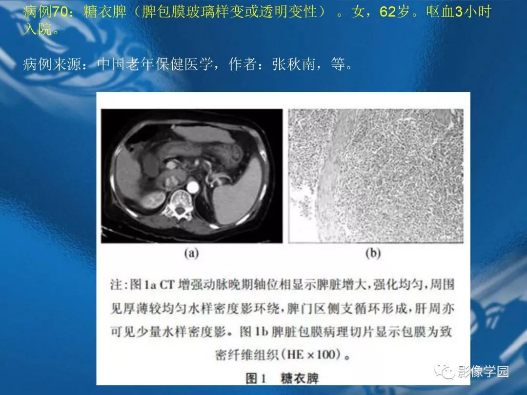 【PPT】脾脏病变大汇集