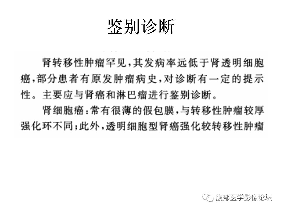 【病例】右肾透明细胞肾癌1例CT