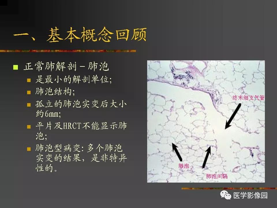 【PPT】间质性肺疾病及其影像诊断