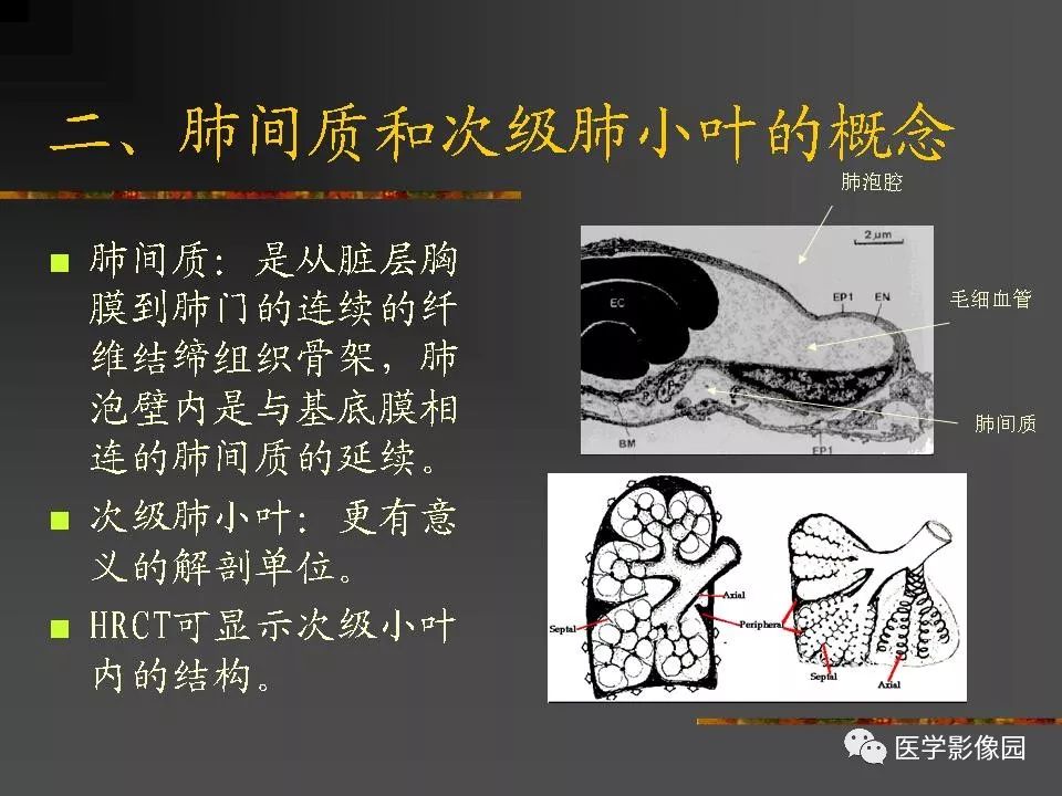 【PPT】间质性肺疾病及其影像诊断