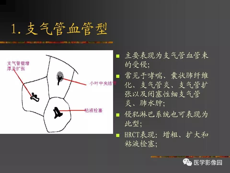 【PPT】间质性肺疾病及其影像诊断