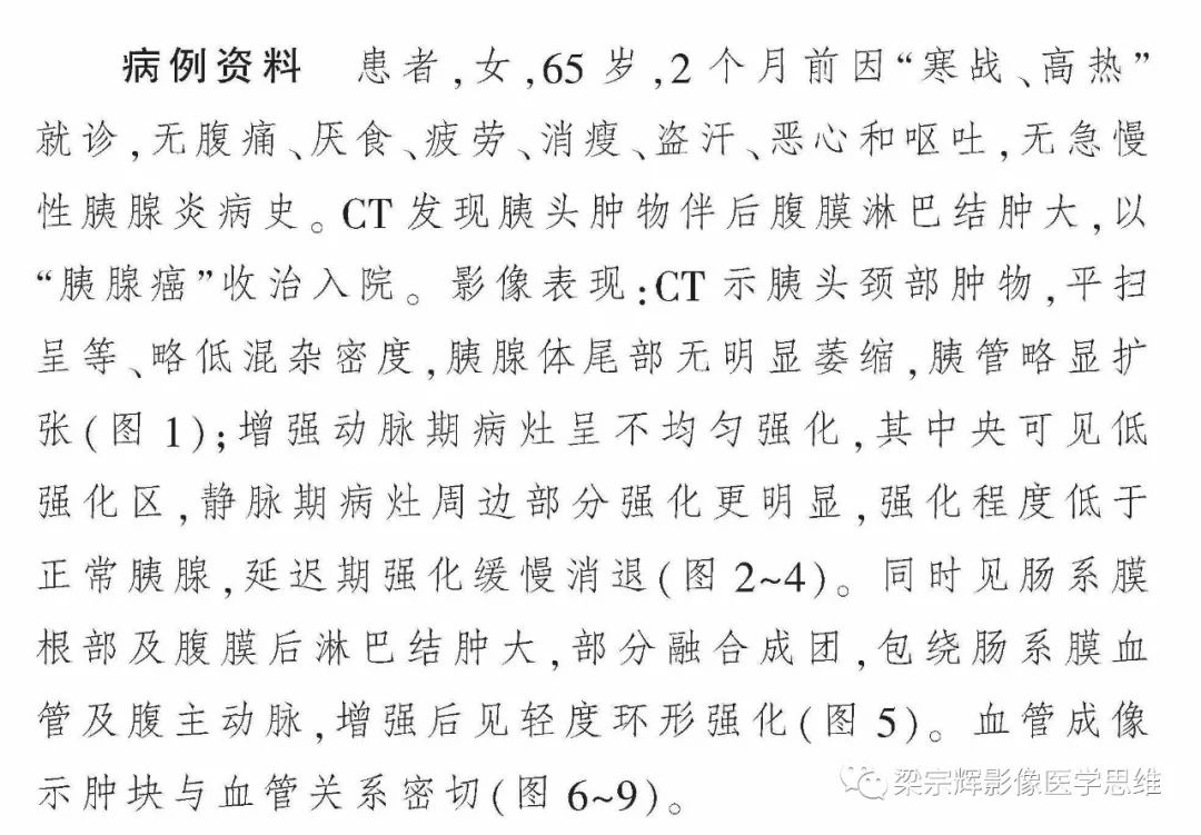 【病例】胰腺结核1例CT影像诊断思维