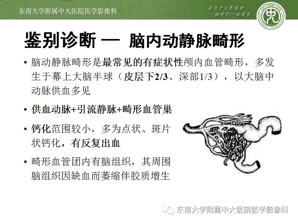 【病例】Sturge-Weber综合征2例CT及MR 【病例】Sturge-Weber综合征2例CT及MR