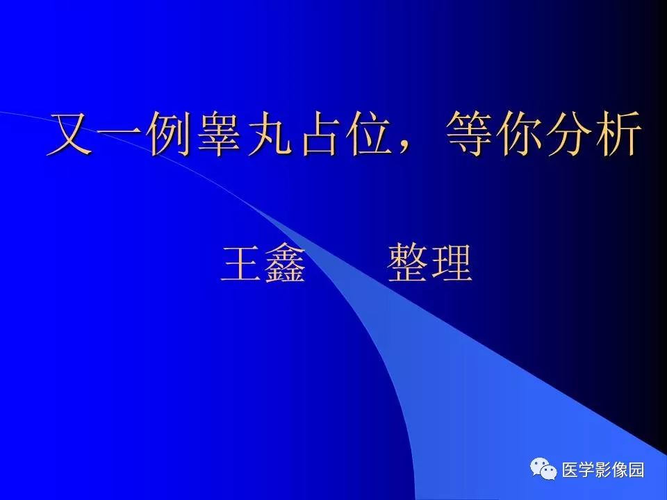【病例】睾丸精原细胞瘤伴腹膜后转移1例CT