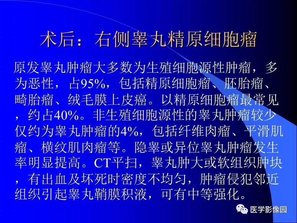 【病例】睾丸精原细胞瘤伴腹膜后转移1例CT
