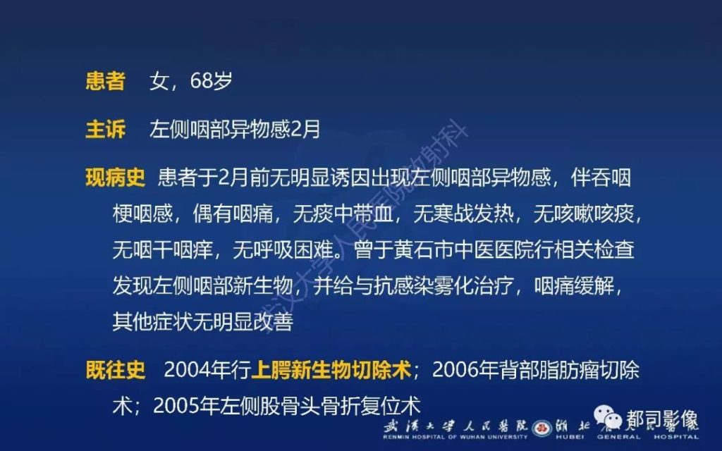 【病例】软腭肌上皮癌1例CT影像诊断