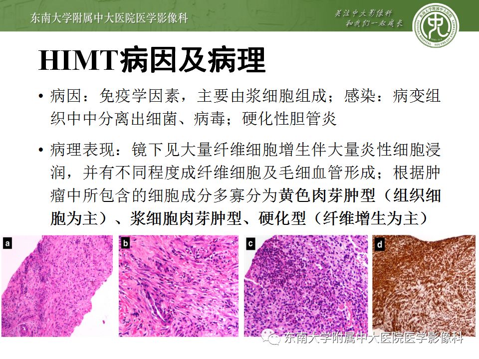 【病例】肝脏炎性肌纤维母细胞瘤1例CT影像表现