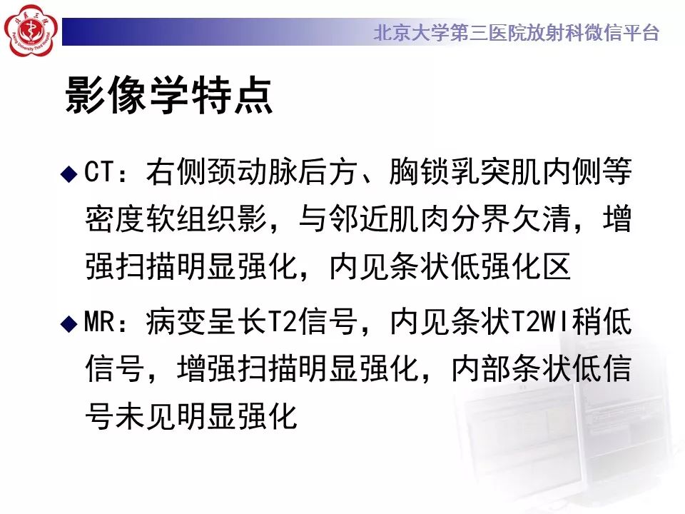 【病例】腹外型韧带样纤维瘤病1例CT及MR
