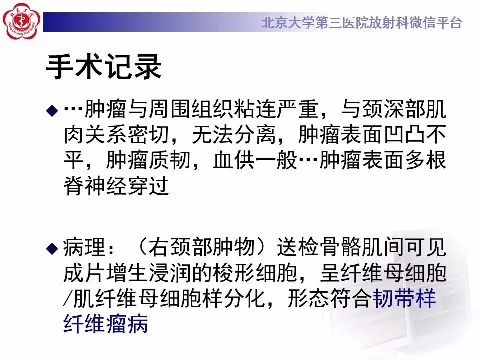 【病例】腹外型韧带样纤维瘤病1例CT及MR