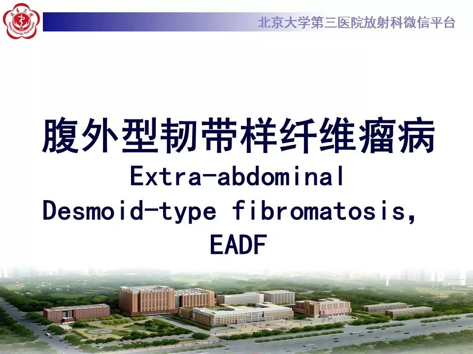 【病例】腹外型韧带样纤维瘤病1例CT及MR
