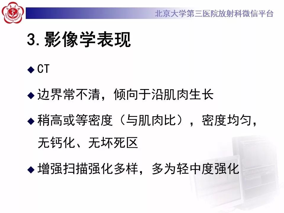 【病例】腹外型韧带样纤维瘤病1例CT及MR