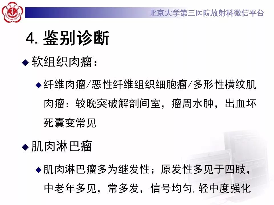 【病例】腹外型韧带样纤维瘤病1例CT及MR