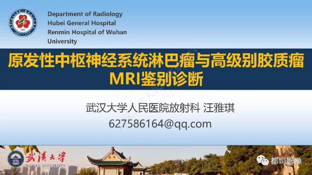 【PPT】原发性中枢神经系统淋巴瘤与高级别胶质瘤MRI鉴别诊断