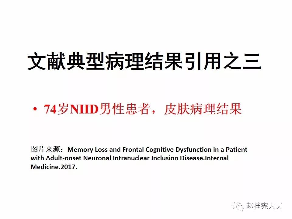 【PPT】神经元核内包涵体病（NIID）