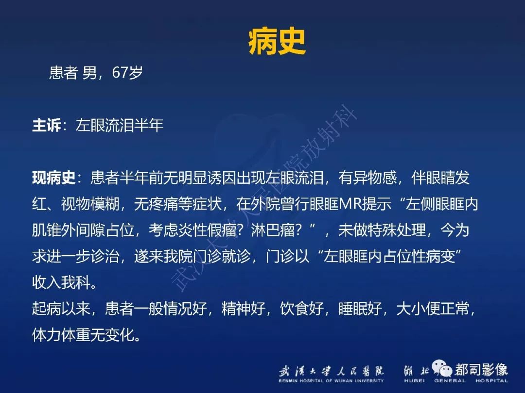 【PPT】眼眶黏膜相关淋巴组织淋巴瘤影像诊断