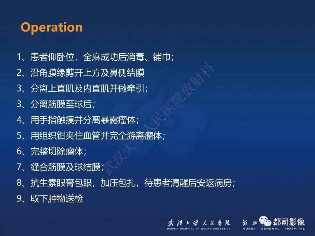【PPT】眼眶黏膜相关淋巴组织淋巴瘤影像诊断