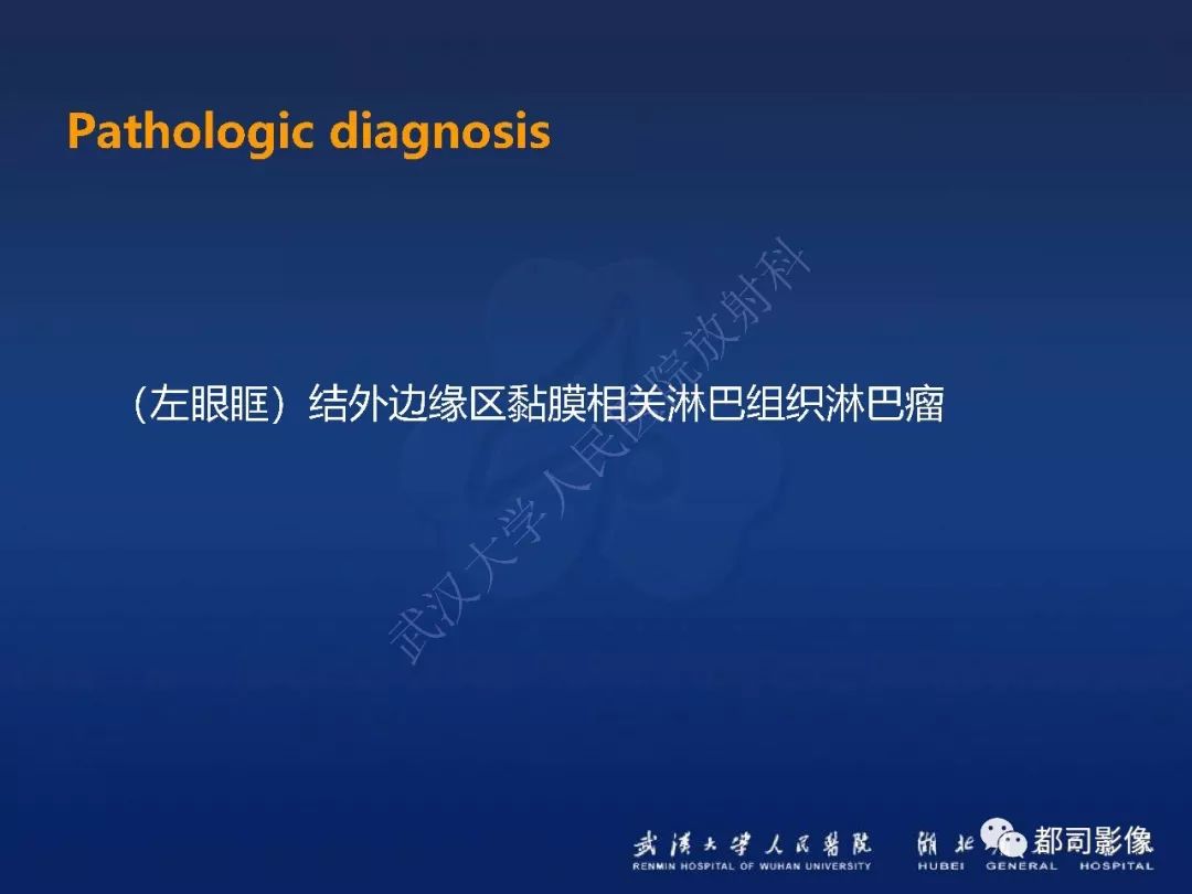【PPT】眼眶黏膜相关淋巴组织淋巴瘤影像诊断