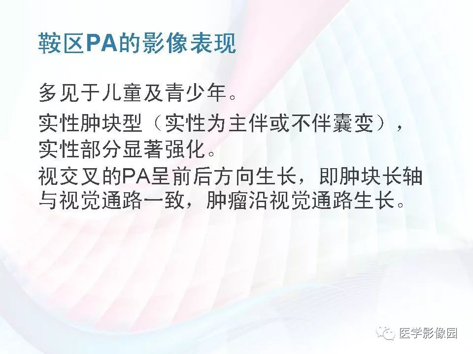【PPT】鞍区毛细胞型星形细胞瘤的MRI诊断及鉴别诊断