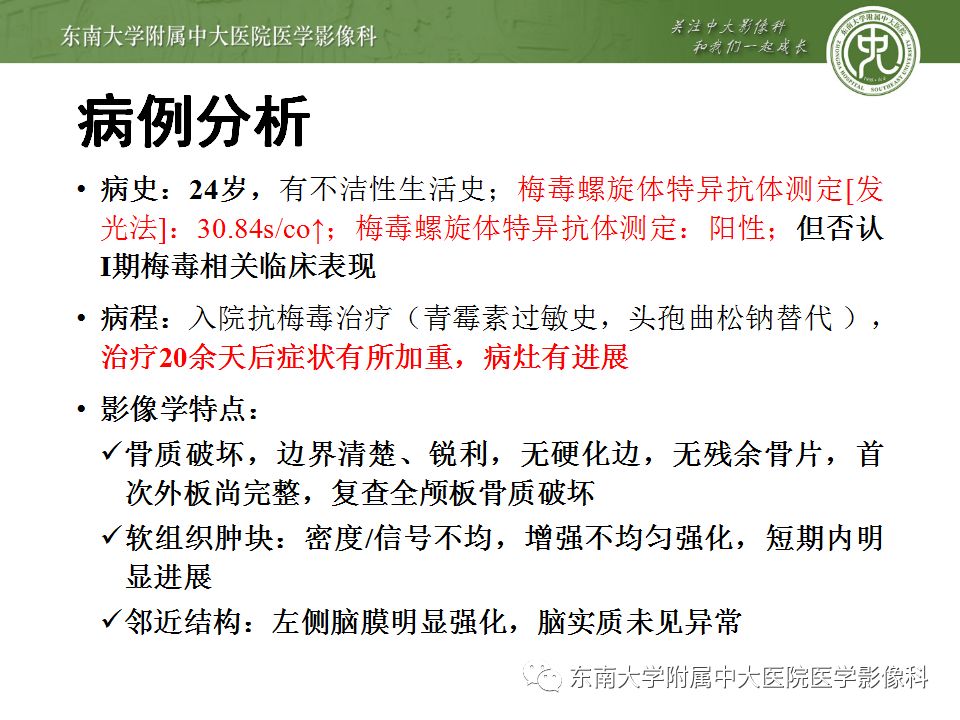 【病例】颅骨嗜酸性肉芽肿1例CT及MR