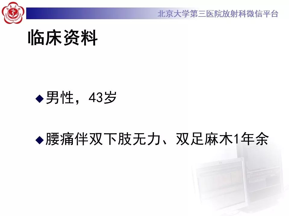 【病例】椎管内脊膜囊肿1例CT及MR