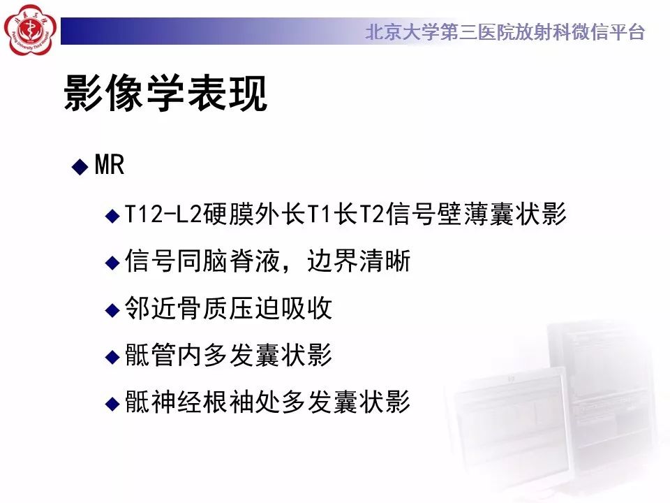 【病例】椎管内脊膜囊肿1例CT及MR