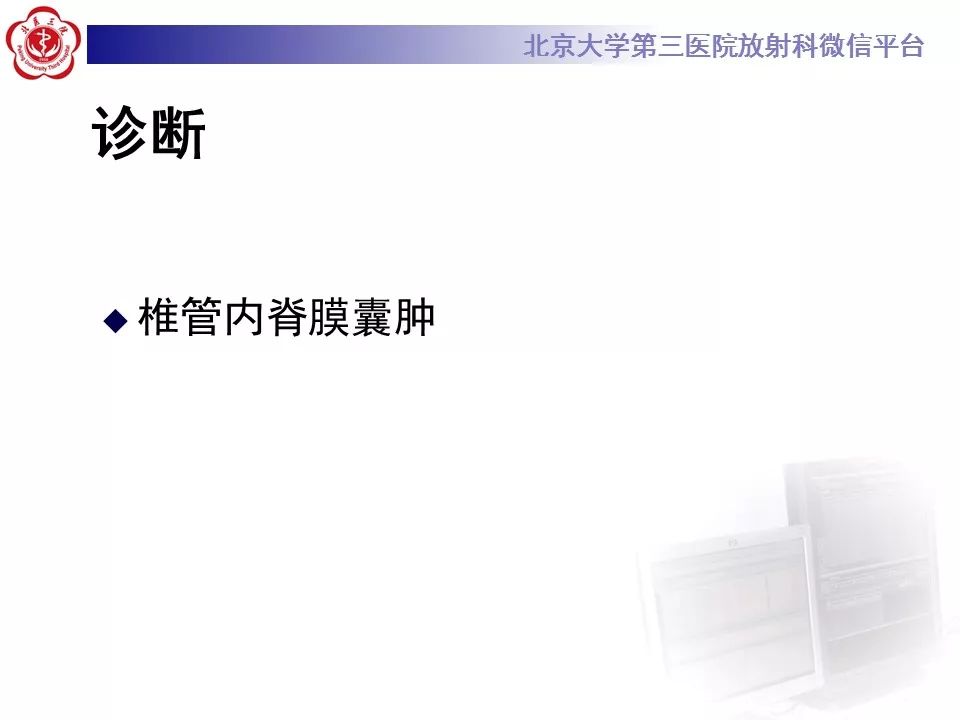 【病例】椎管内脊膜囊肿1例CT及MR
