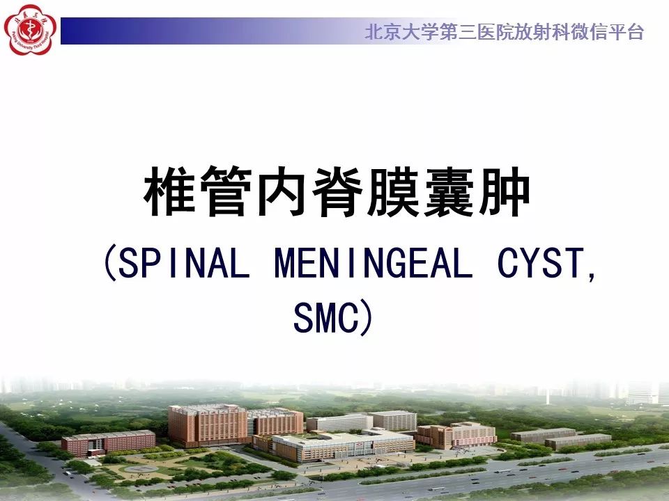 【病例】椎管内脊膜囊肿1例CT及MR