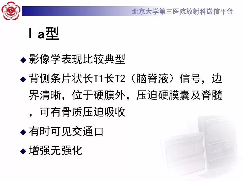 【病例】椎管内脊膜囊肿1例CT及MR