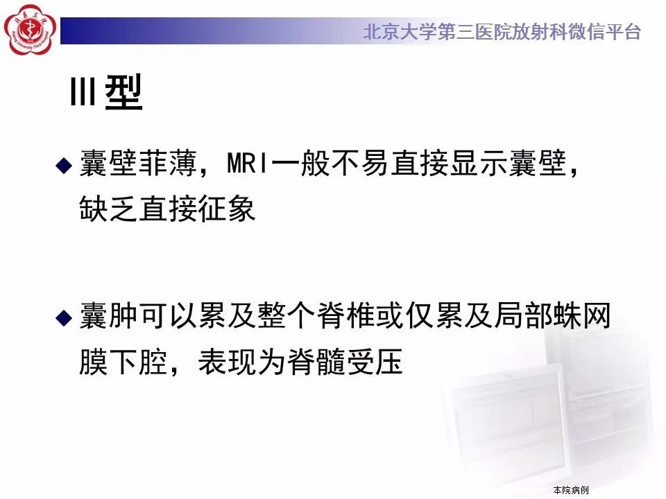 【病例】椎管内脊膜囊肿1例CT及MR