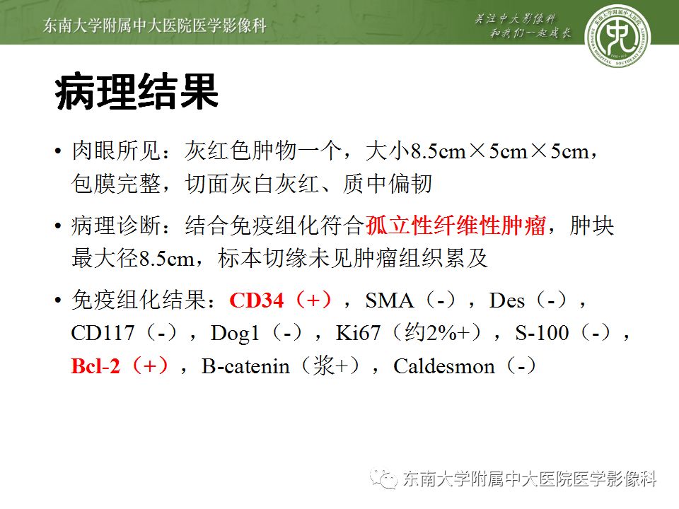 【病例】盆壁孤立性纤维瘤1例CT及MR