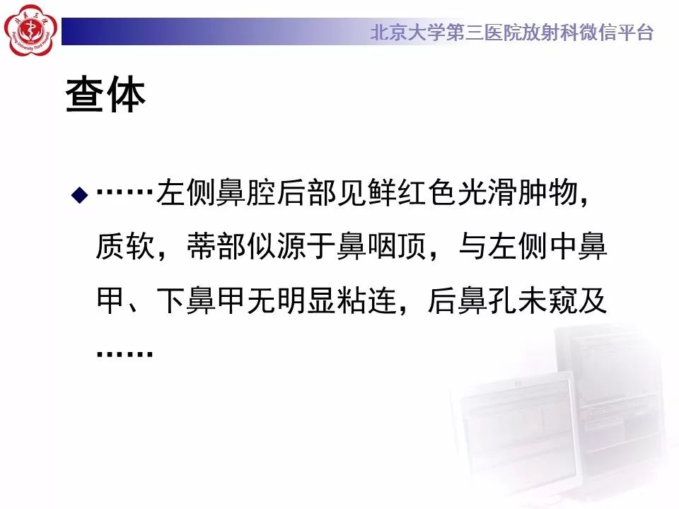 【病例】鼻咽纤维血管瘤1例CT及MR影像诊断