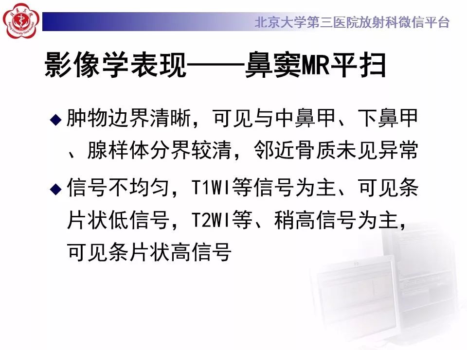 【病例】鼻咽纤维血管瘤1例CT及MR影像诊断