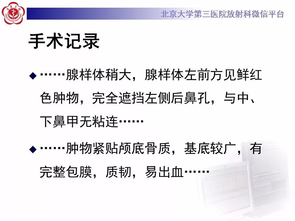【病例】鼻咽纤维血管瘤1例CT及MR影像诊断