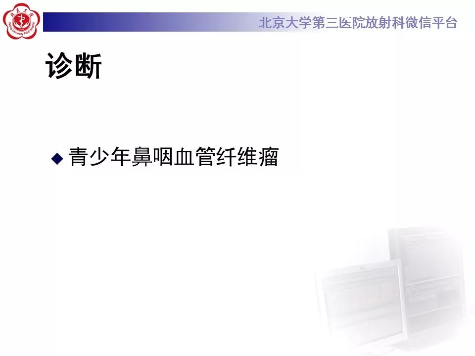 【病例】鼻咽纤维血管瘤1例CT及MR影像诊断