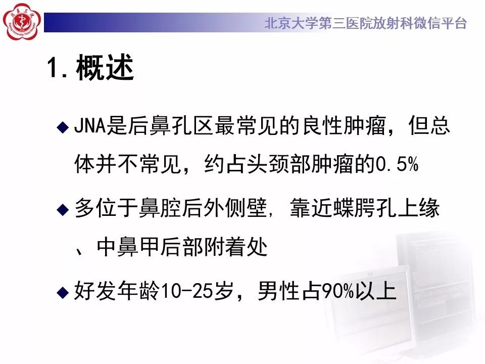 【病例】鼻咽纤维血管瘤1例CT及MR影像诊断