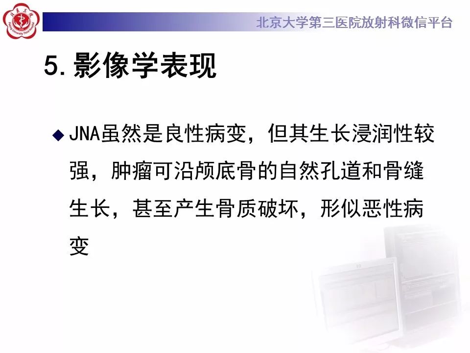 【病例】鼻咽纤维血管瘤1例CT及MR影像诊断
