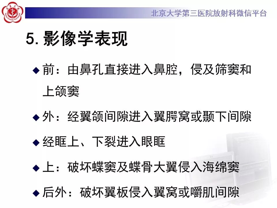 【病例】鼻咽纤维血管瘤1例CT及MR影像诊断