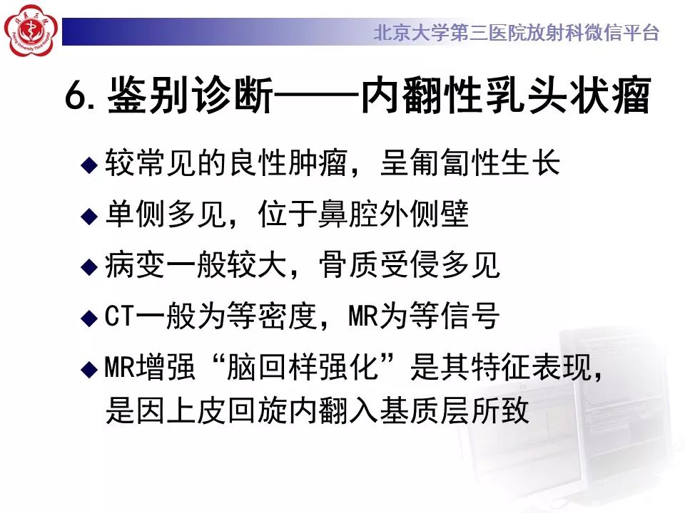 【病例】鼻咽纤维血管瘤1例CT及MR影像诊断