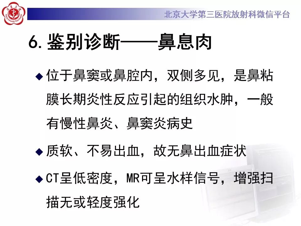 【病例】鼻咽纤维血管瘤1例CT及MR影像诊断