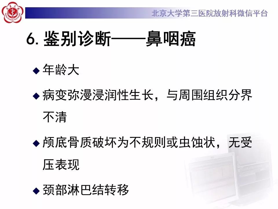 【病例】鼻咽纤维血管瘤1例CT及MR影像诊断