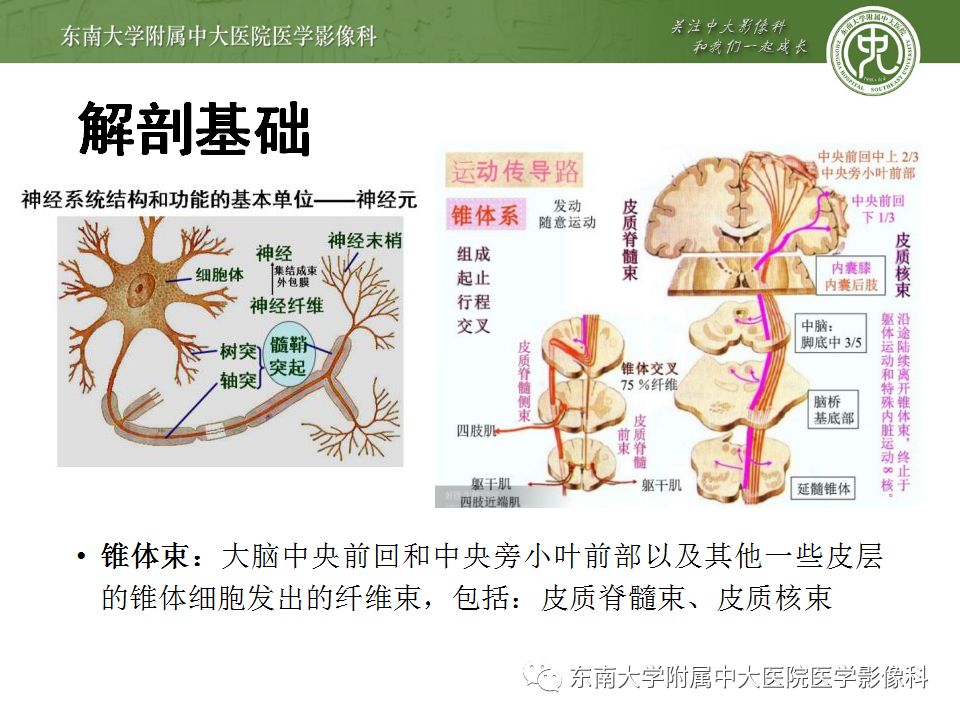 【病例】华勒氏变性1例CT及MR影像诊断