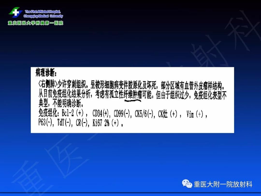 【PPT】孤立性纤维瘤的影像学诊断及鉴别诊断