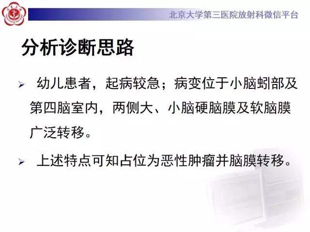 【病例】髓母细胞瘤1例CT及MR影像诊断