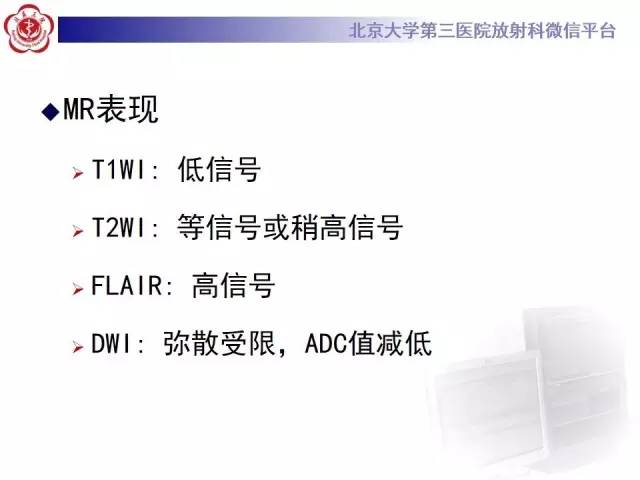 【病例】髓母细胞瘤1例CT及MR影像诊断