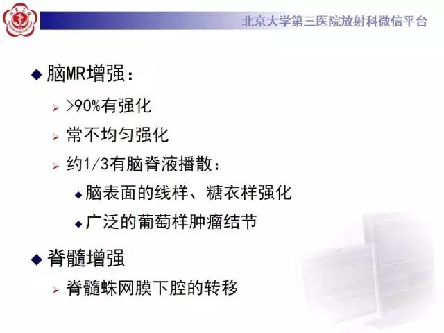 【病例】髓母细胞瘤1例CT及MR影像诊断