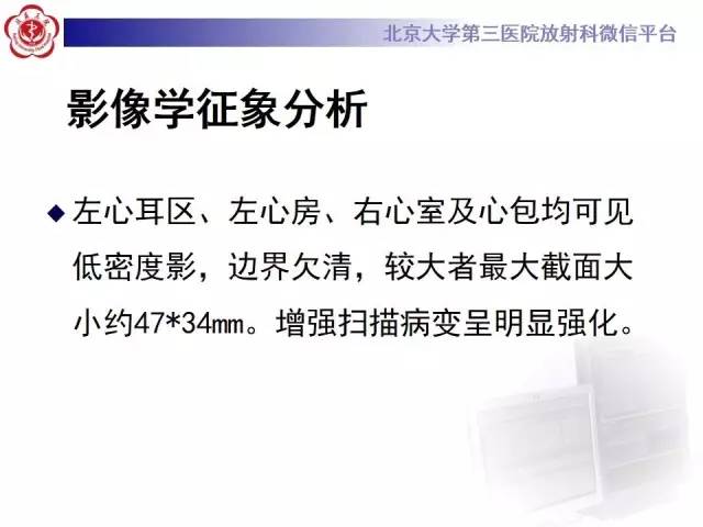 【病例】心脏原发性肿瘤1例CT影像表现